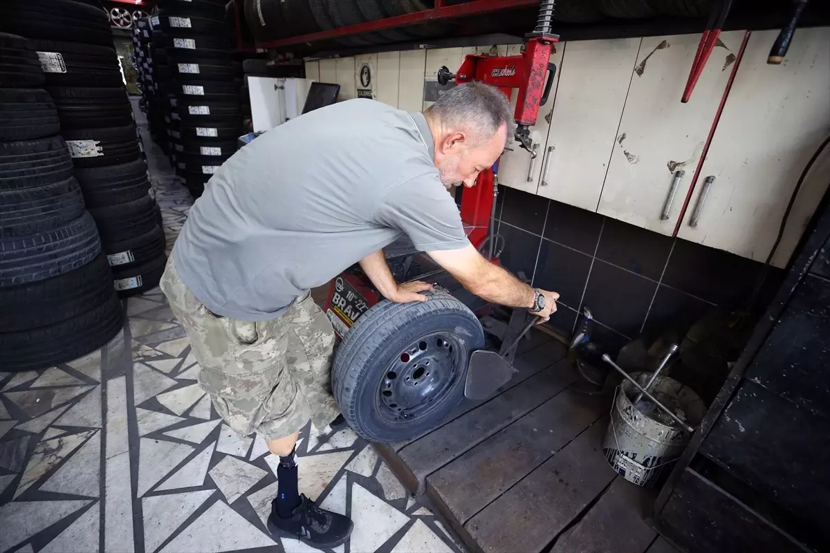 gazilikle hayata tutunan yuksel unal MEsp5V1R