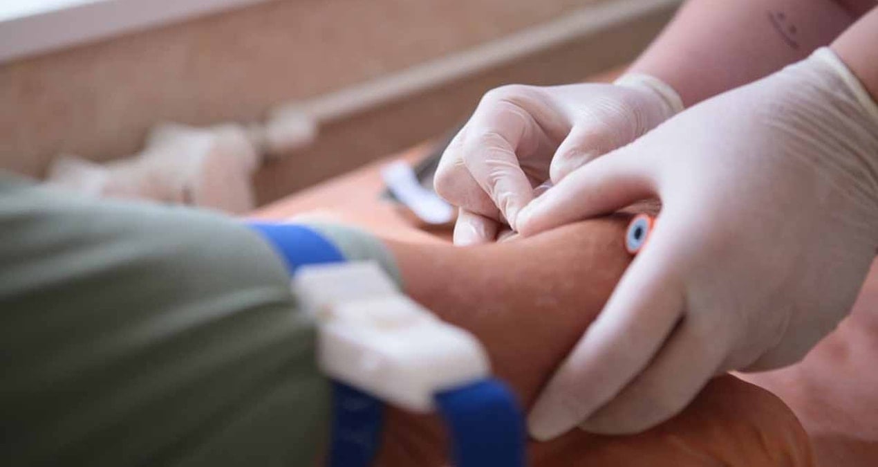 40 yasindan sonra herkesin yaptirmasi gereken 3 kan testi inCUYQIt.jpg