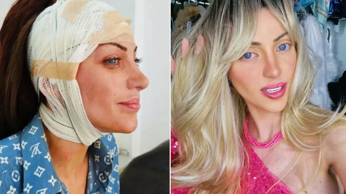 barbie bebege benzemek icin 27 kez ameliyat oldu brezilyali fenomen 31 yasinda hayatini kaybetti Ev58waKI.jpg