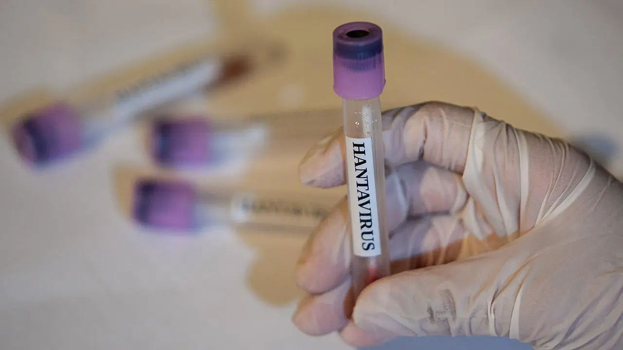 avrupada-hantavirus-alarmi-12-saglik-calisani-karantinada-gATydUHZ